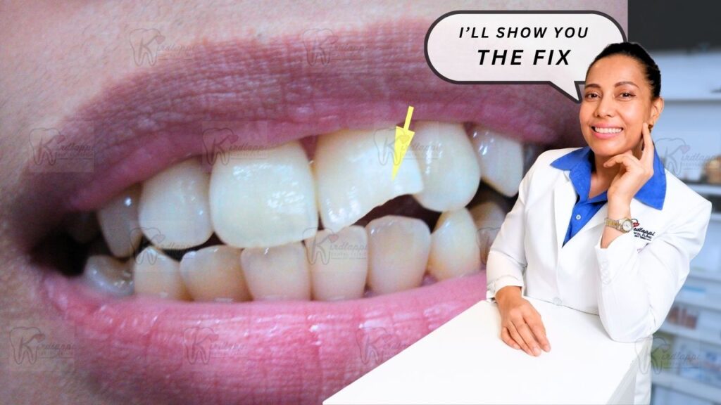 ARTICLE 9 - FEATURED IMAGE - ARTICLE 9 - FEATURED IMAGE - Chipped Tooth? 5 Ways to Fix It Fast (Before It Gets Worse)